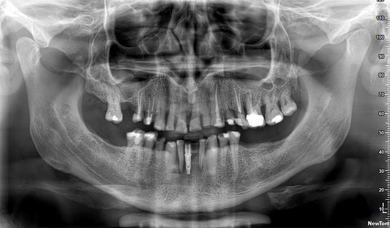 Radiografia originale